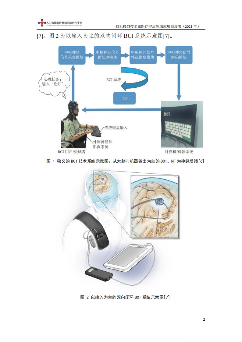 脑机接口加速进入临床试验 今年市场规模有望突破38亿元