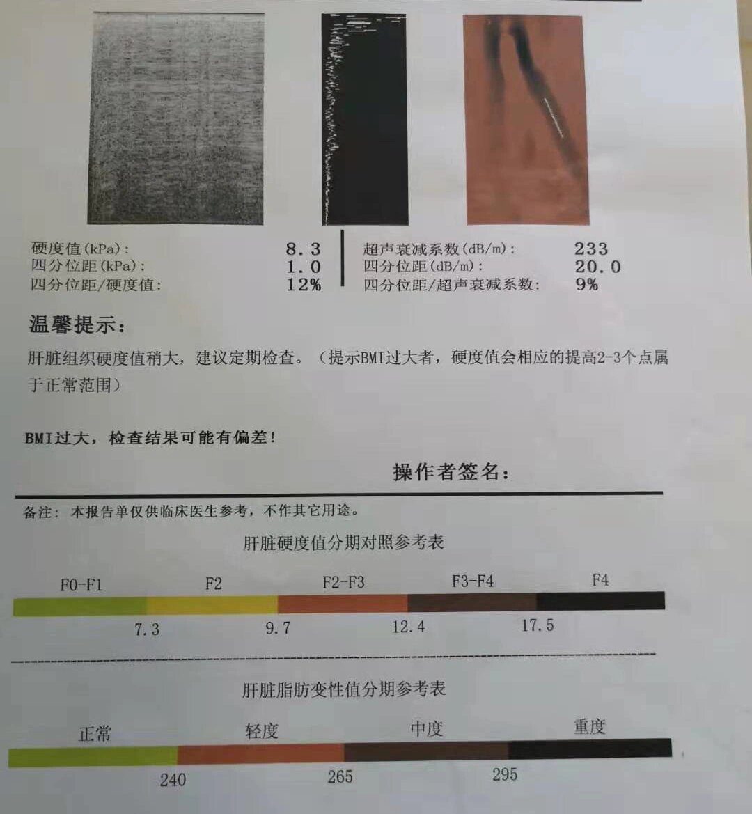 百洋医药：扶正化瘀片是国家医保和基药品种在抗肝纤维化领域占据领先地位