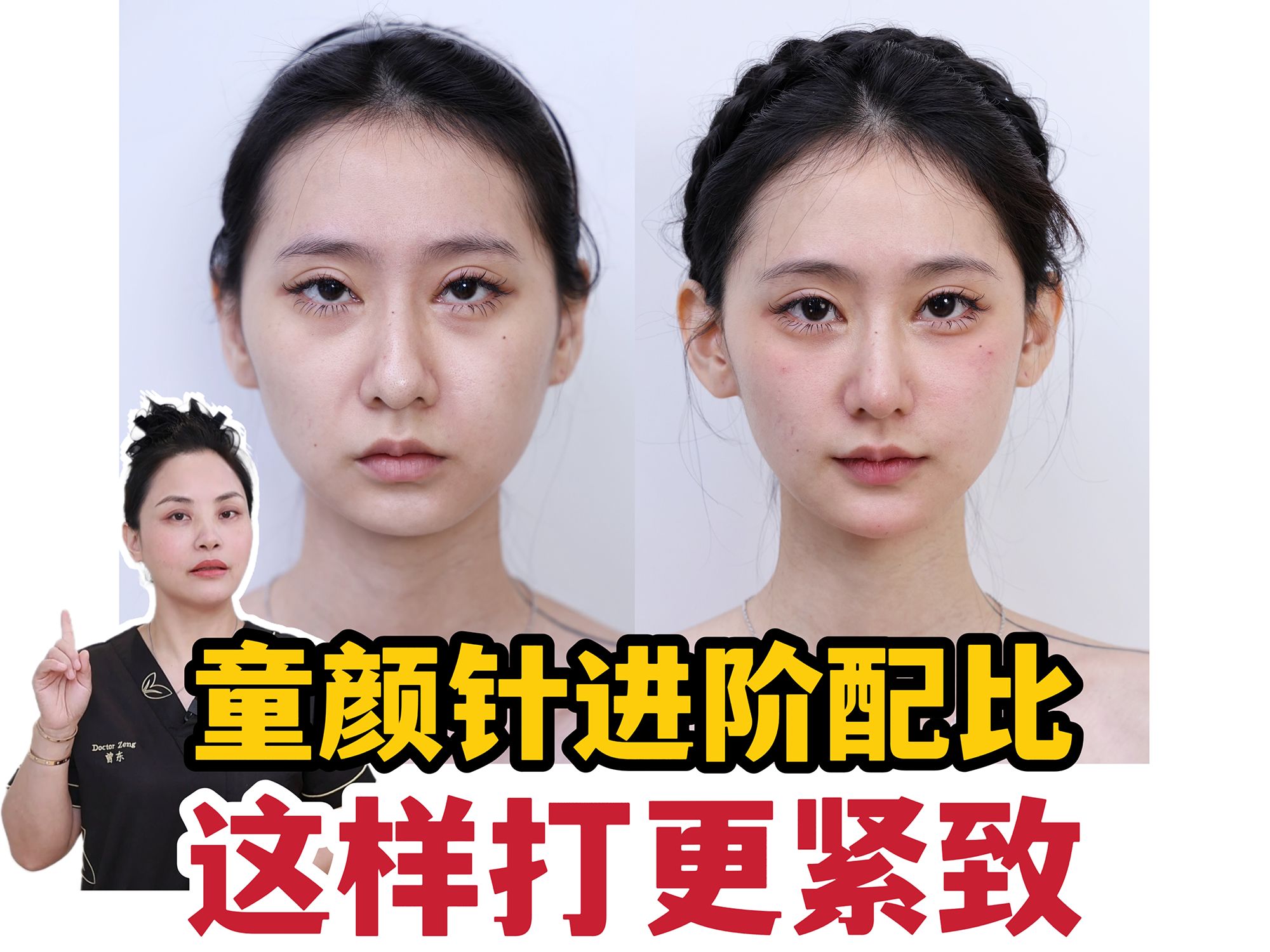 争夺艾塑菲中国代理权，谁更需要“童颜针”