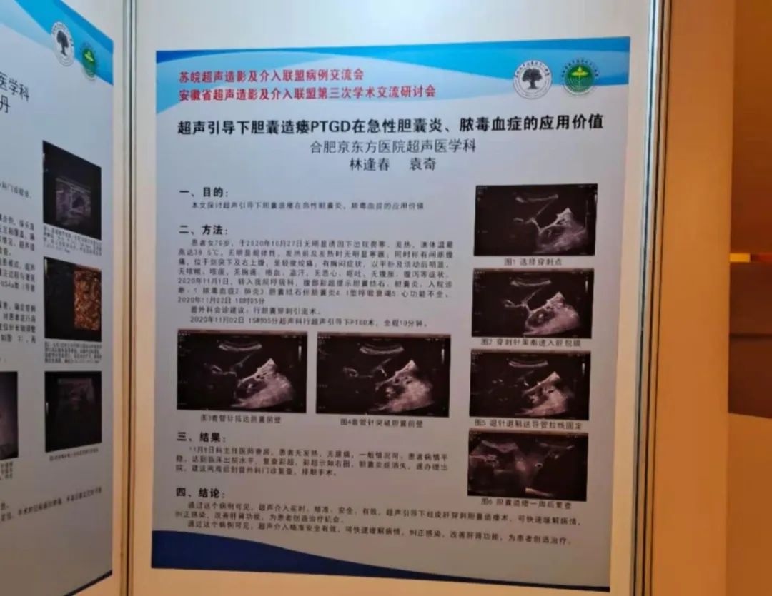 京东方A公布国际专利申请:“超声检测基板以及超声成像装置”