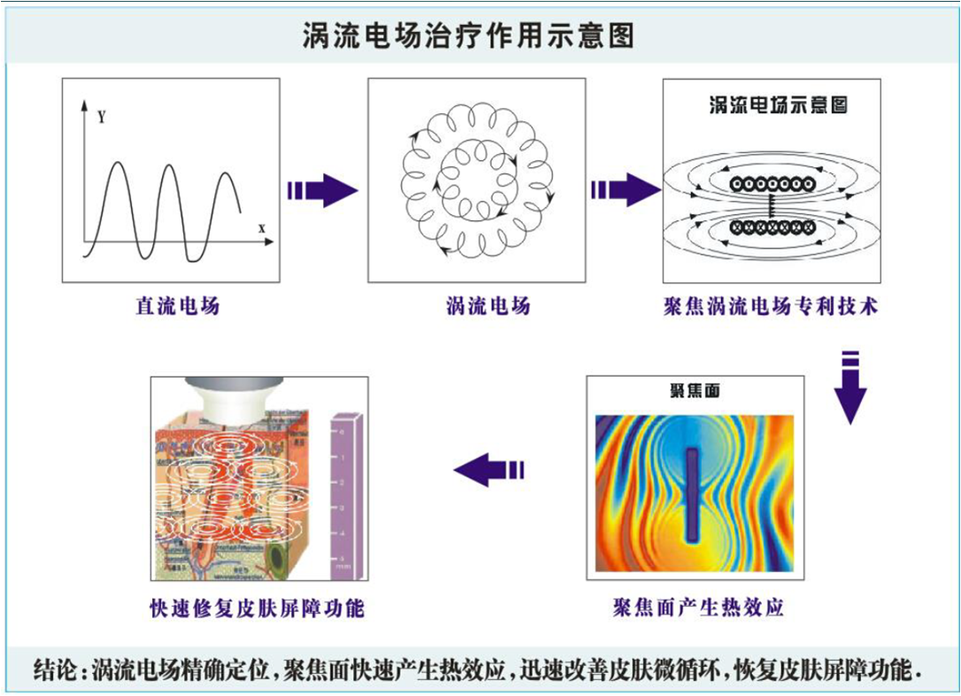中科电气公布国际专利申请：“一种通道式感应加热中间包的涡流防护系统”