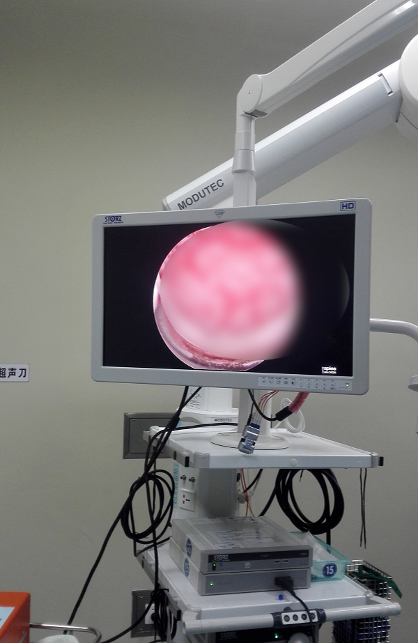 百洋医药：ZAP-X放射外科机器人提升脑肿瘤治疗效率